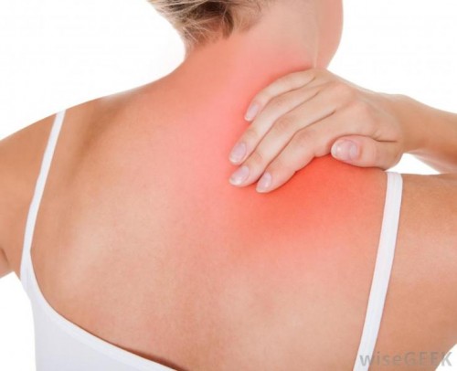 Viêm quanh khớp vai gây ra các cơn đau nhói khi ấn vào vùng khớp vai