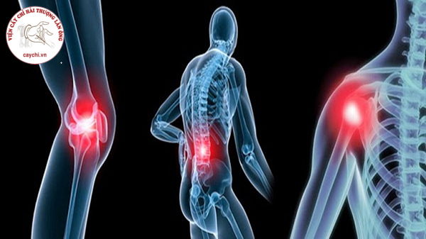 Bệnh xương khớp với nhiều điểm đau khác nhau trong cơ thể tạo ra nhiều hệ lụy tồi tệ trong cuộc sống người bệnh