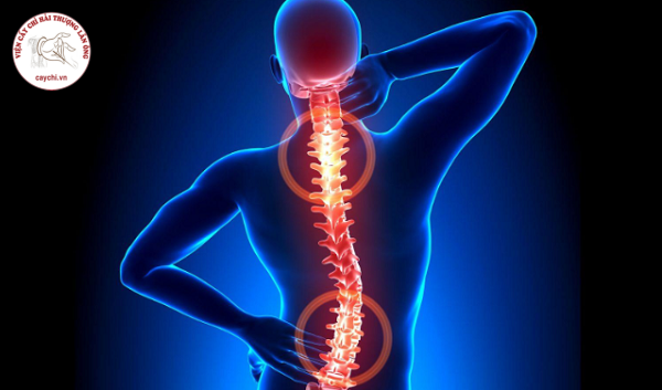 Cơn đau lan rộng theo dây thần kinh ra các chi và tăng nặng khi cử động khiến người bị thoái hóa cột sống khổ sở và chỉ muốn nằm hay ngồi một c